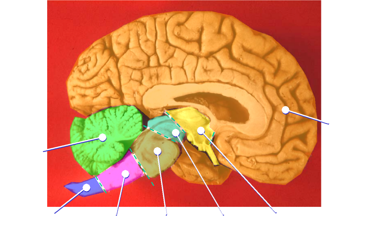 Pig Brain Dissection